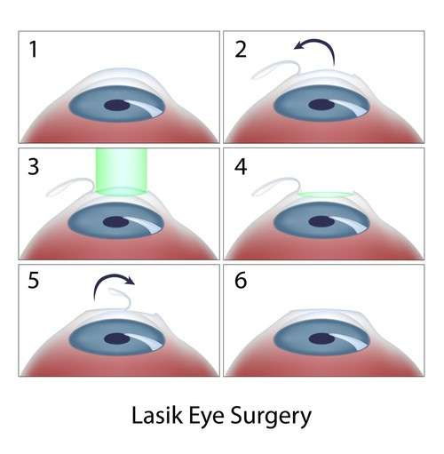 Lasik Surgeon in Aurangabad Shri Krishna Netralaya