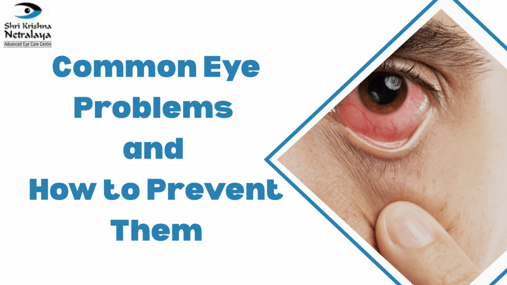 Common Eye Problems and How to Prevent Them