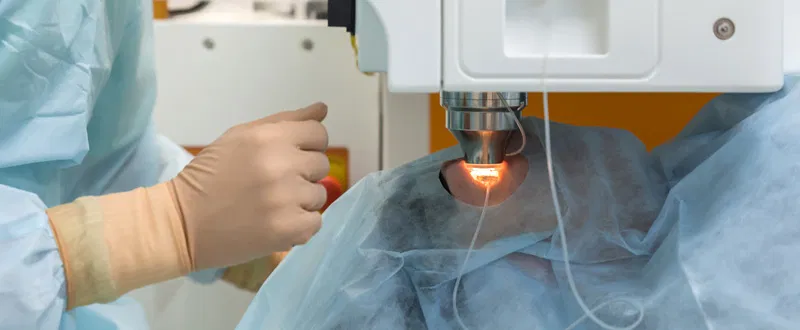 LASIK, SMILE, and Contoura Vision Are Not the Same Procedure — Here Is What Actually Differs