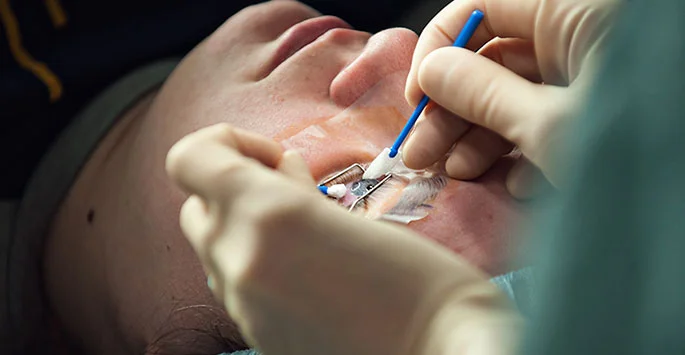 Is LASIK Surgery 100% Successful? What No One Tells You Before the Procedure
